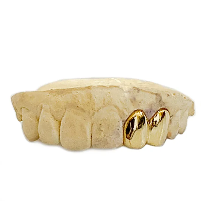 Bling Cartel Admin PreStyled Sets Real 10K Gold Double Caps Side Canine Custom Grillz Bling Cartel Admin PreStyled Sets Real 10K Gold Double Caps Side Canine Custom Grillz